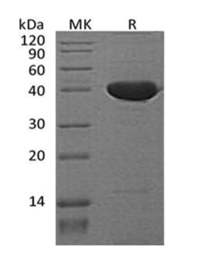 Recombinant Mouse Pigment Epithelium-Derived Factor/PEDF/SERPIN F1